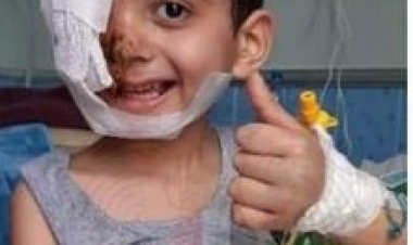 فريق طبي ينجح بإنقاذ يد طفل سوري من البتر بعد بقائه 36 ساعة تحت الأنقاض