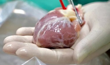 لأول مرة في آسيا..أطباء صينيون يزرعون قلبا لرضيعة لم تتم الشهرين