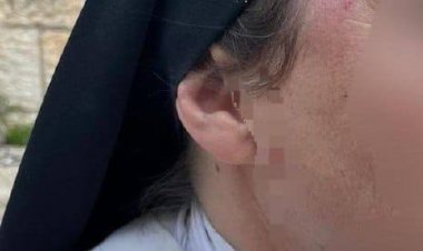 حين تُضرب الراهبة… تُفضَح المدينة