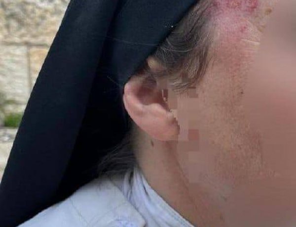 حين تُضرب الراهبة… تُفضَح المدينة